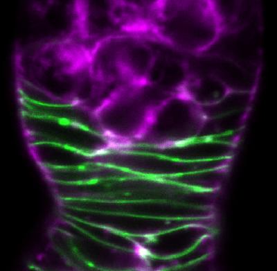 The Switch That Stops Sex Cells Of Eurekalert