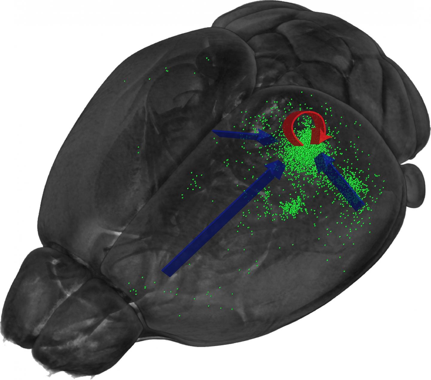 Altered Brain Connectivity May Be Hallmark Of EurekAlert