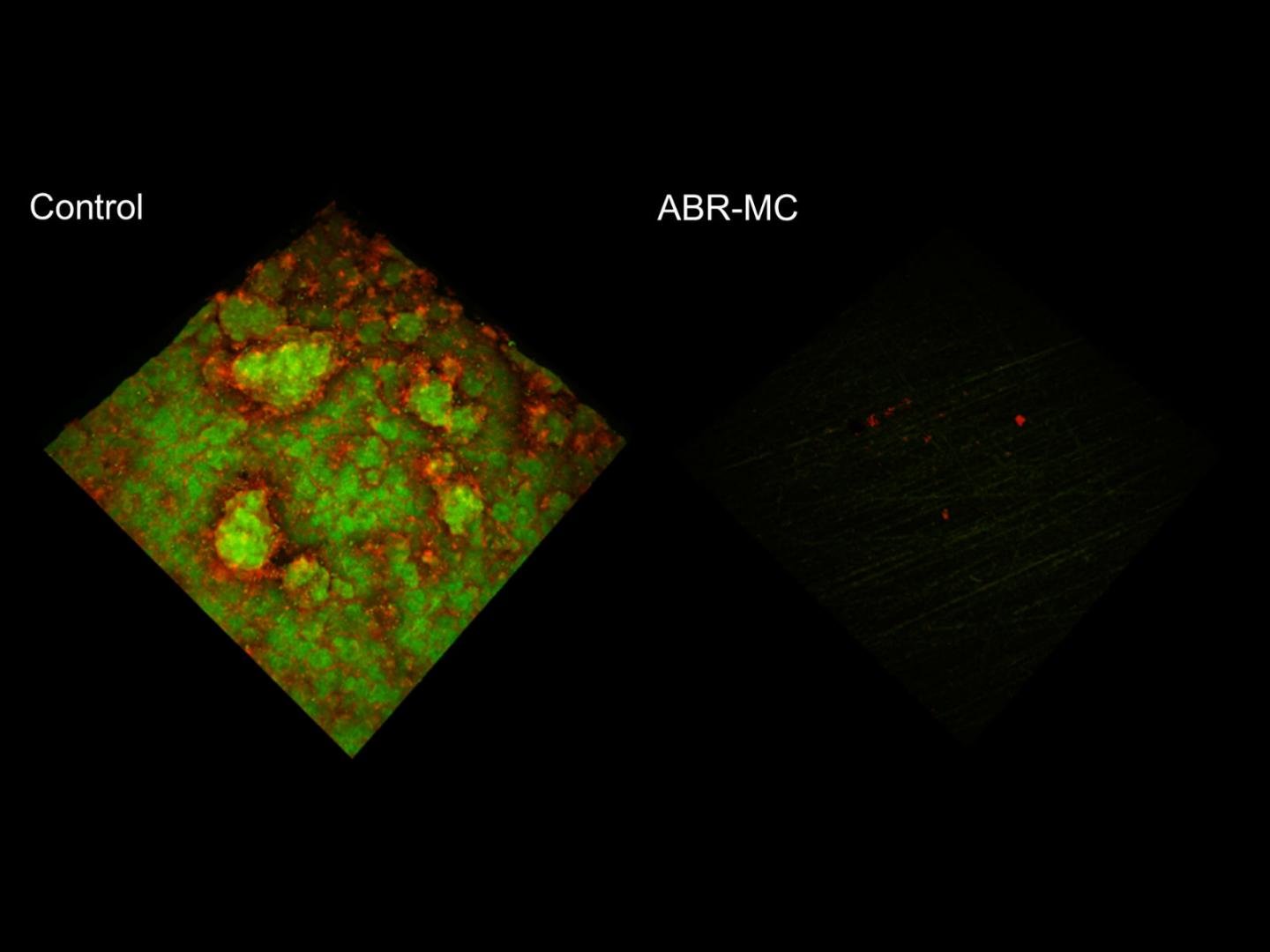 Antimicrobial Dental Material