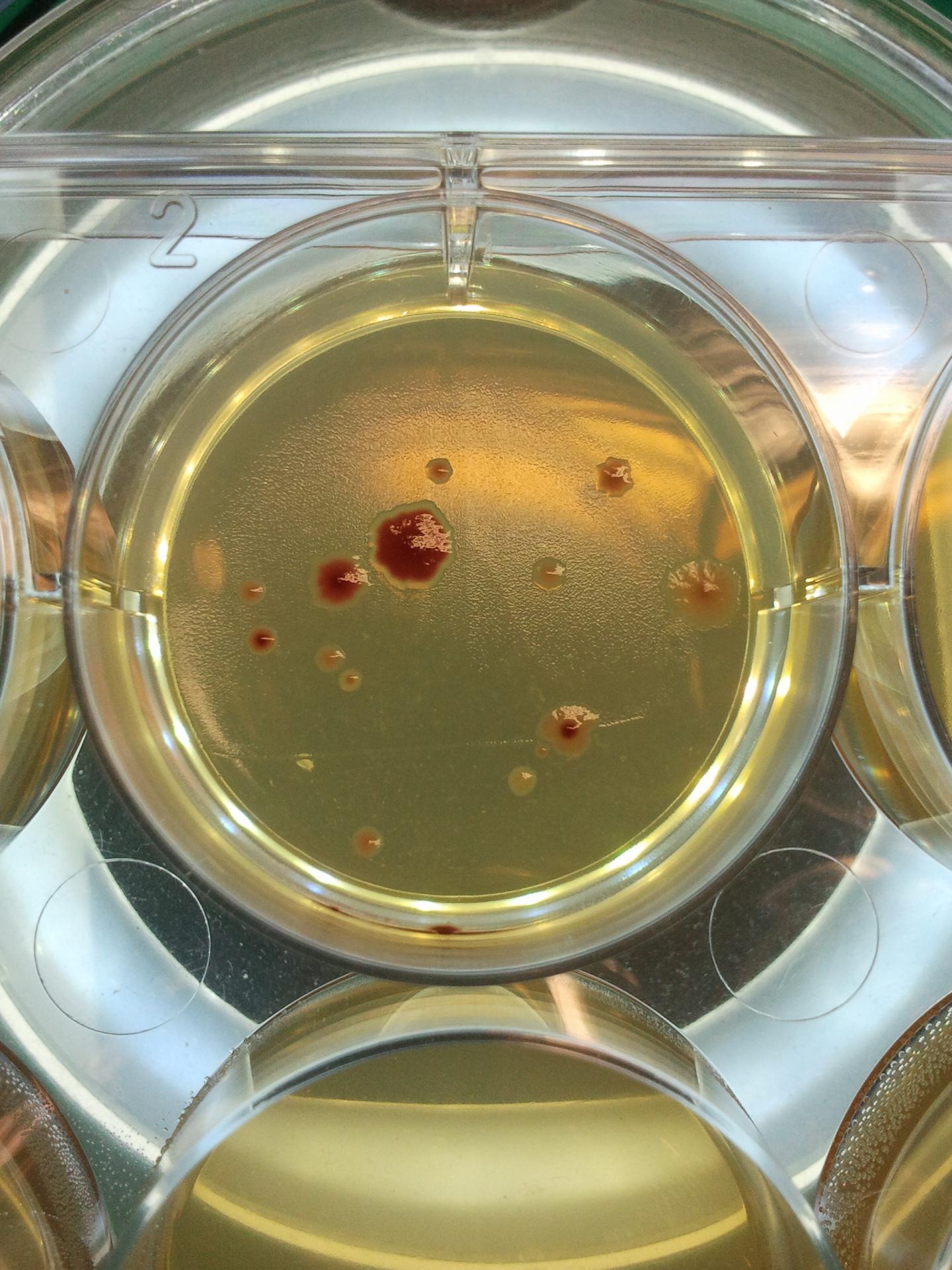 Antibiotic-Resistant <i>E. coli</i> Bacteria Growing in the Lab (1 of 2)