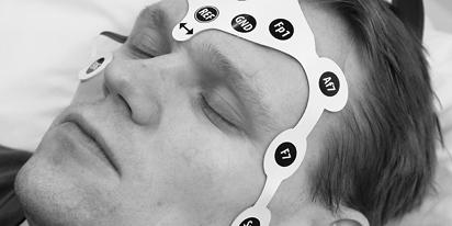 EEG Electrode Set Placed Below the Hairline