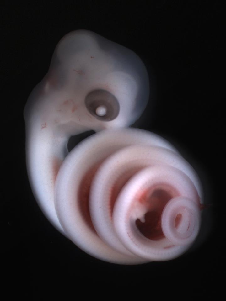 Corn Snake Embryo (2 of 2) [IMAGE] EurekAlert! Science News Releases