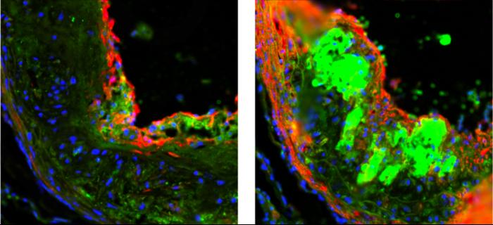 Damaged mice muscle after sweetener