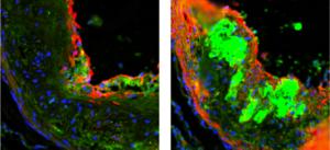 Damaged mice muscle after sweetener