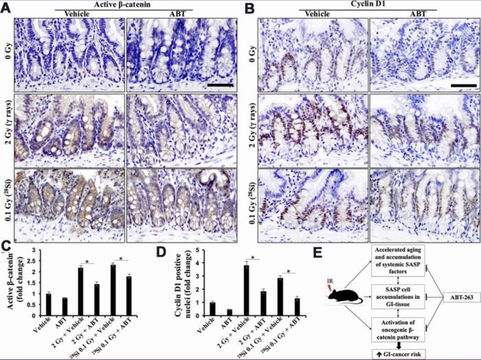 Senolytic agent ABT-263 mitigates low- and high-LET radiation-induced gastrointestinal cancer development in Apc1638N/+ mice