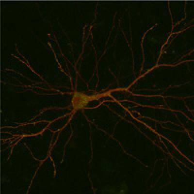 Neuron
