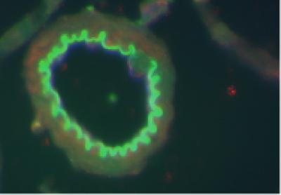 Leukemic and Chemokine Cells (2 of 2)