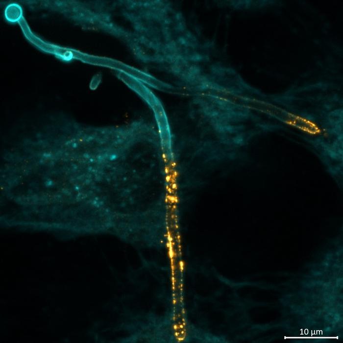 The fungus Candida albicans (blue colouring) invades a human epithelial cell and produces the toxin Candidalysin (yellow colouring)