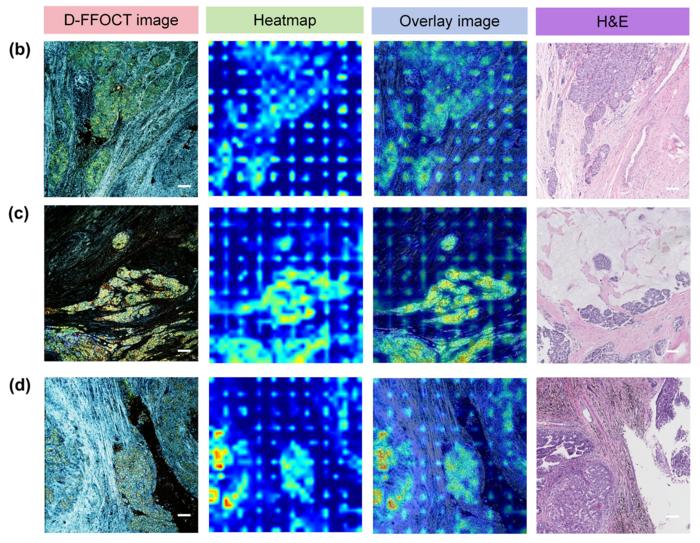 D-FFOCT images, Score-CAM heatmaps, overlay images and corresponding H&E images.