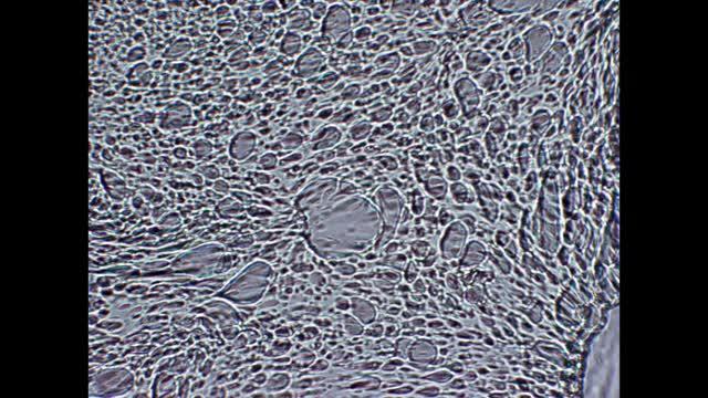 Formation of microfibrils