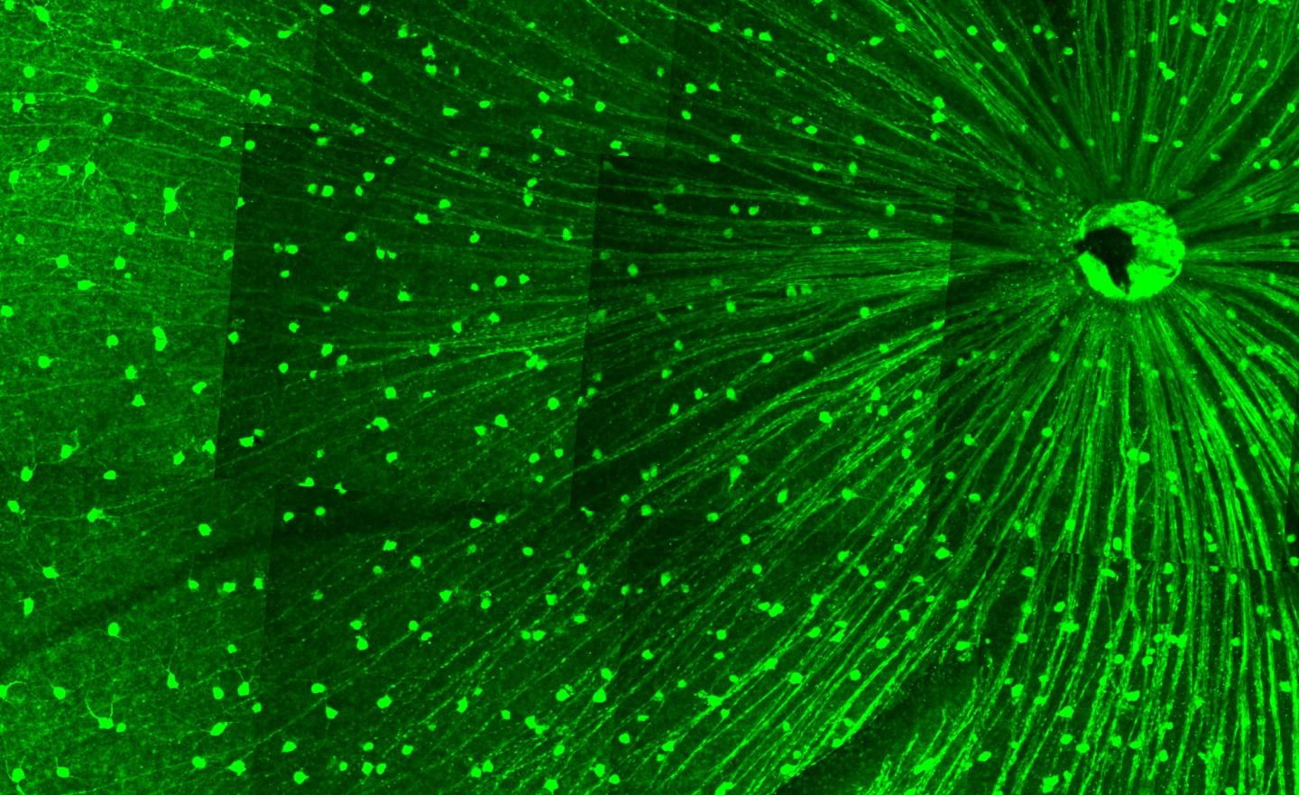 Alpha-Type Retinal Ganglion Cells in Part of an Intact Mouse Retina