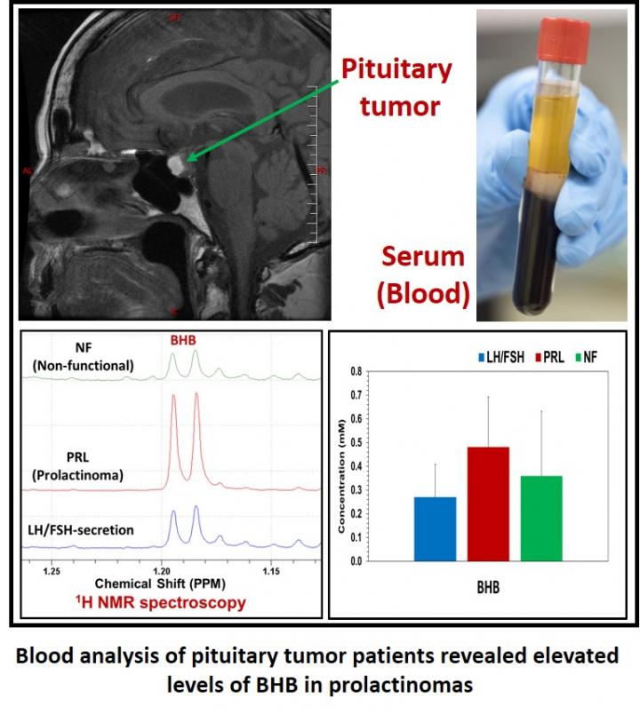Blood Analysis of Pituitary Tumor Patients Reveals Elevated Levels of BHB in Prolactinomas
