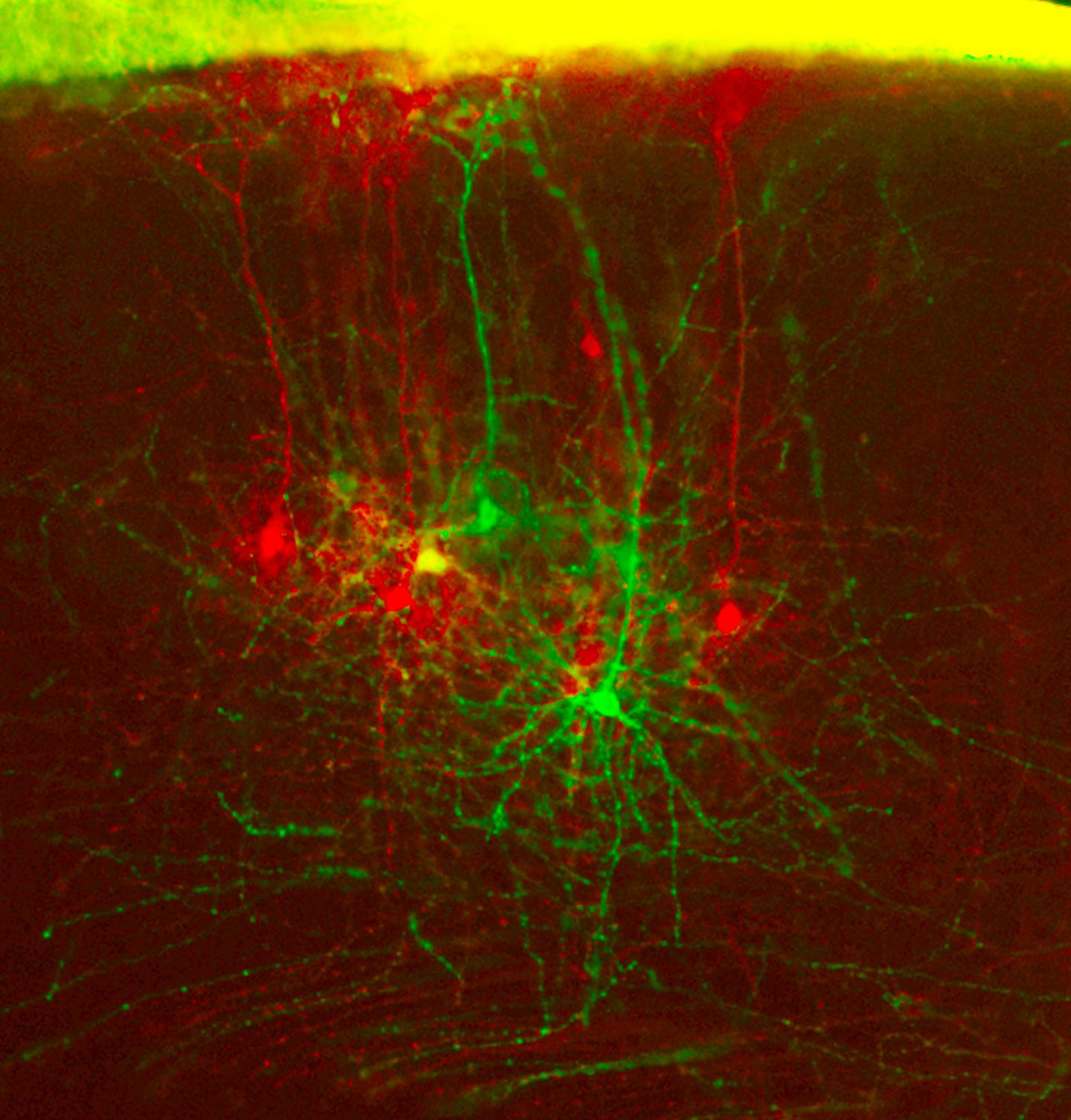 Scientists at the Salk Institute Discovered New Details into How Master Proteins Dictate Neuron's Sp