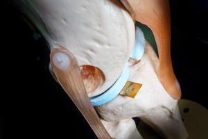 Force sticker in model knee joint