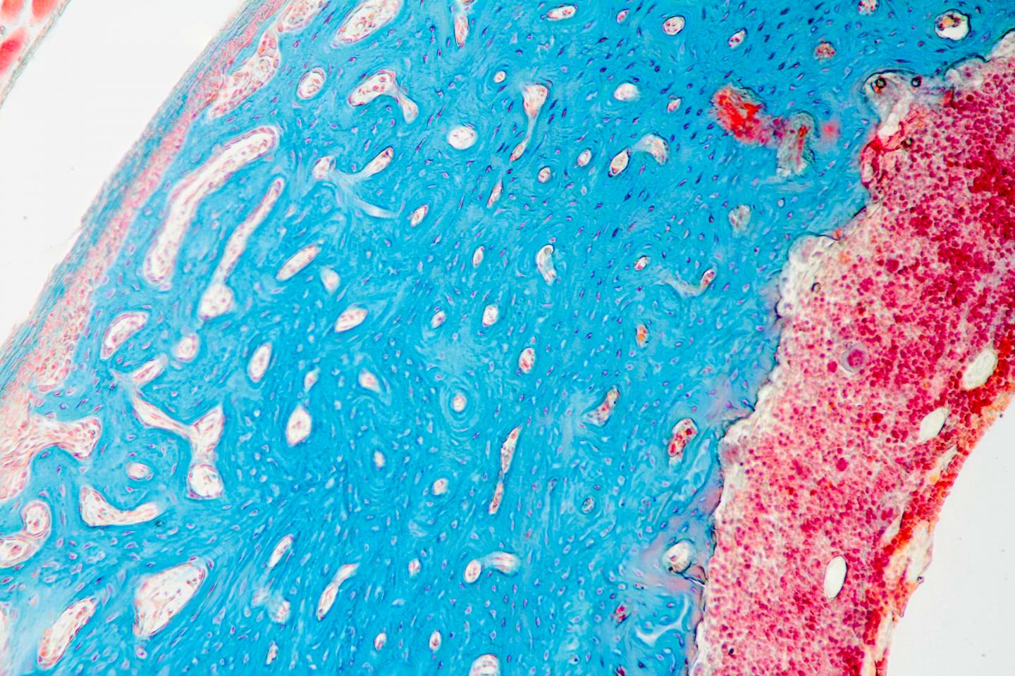 Cross Section of a Femur Bone