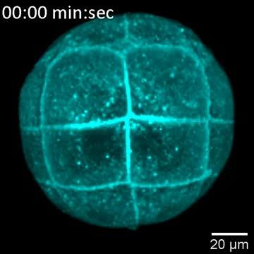 Deformation of soft dividing cells by tissue tension