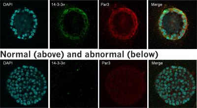 Normal and Abnormal Breastmilk Cells (3 of 3)