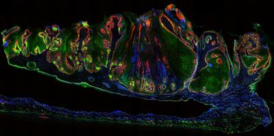 Cross-section of Mouse Skin Tumor