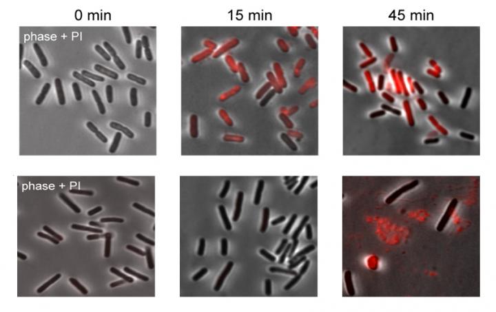 E coli bacteria