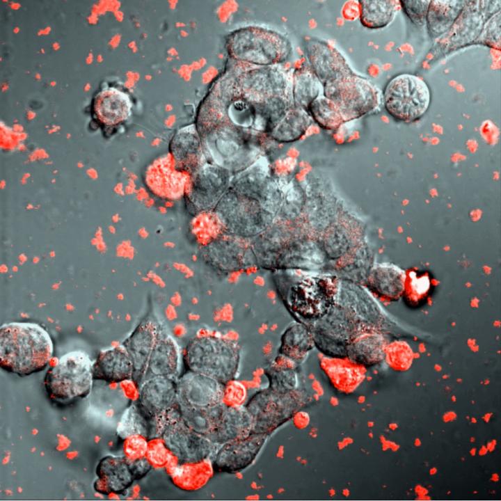 Exosomes Loaded with Catalase Cluster around a Neuron.