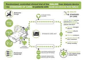 New liver dialysis device shows potential to resolve liver failure in patients with acute-on-chronic liver failure