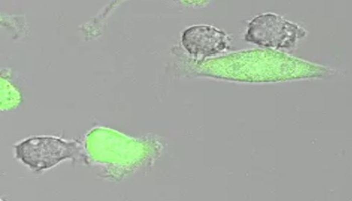Macrophages (grey) attacking tumor cells (green)