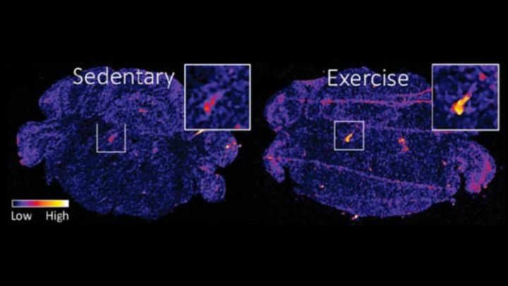 Brainstem Protein Mediates Exercise-Based Stress Relief