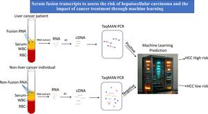 New Screening Tool Could Improve the Survival Rate of Patients with Hepatocellular Carcinoma from 20% to 90%