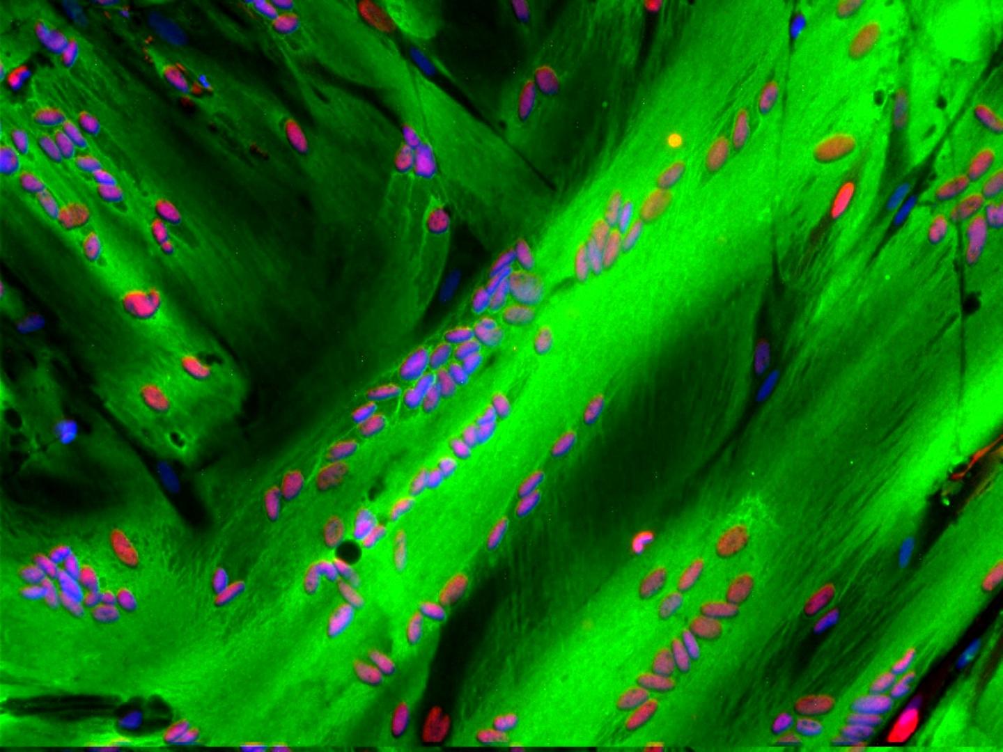 Muscle Developed From Stem Cells