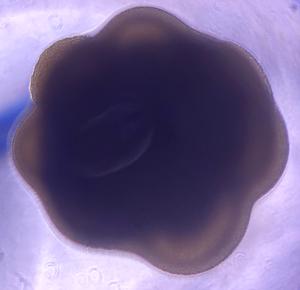 A two-month-old cerebral organoid viewed under the microscope