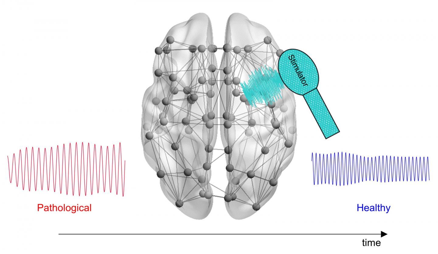 New Computational Tool Could Help Optimize Treatment of Alzheimer's Disease