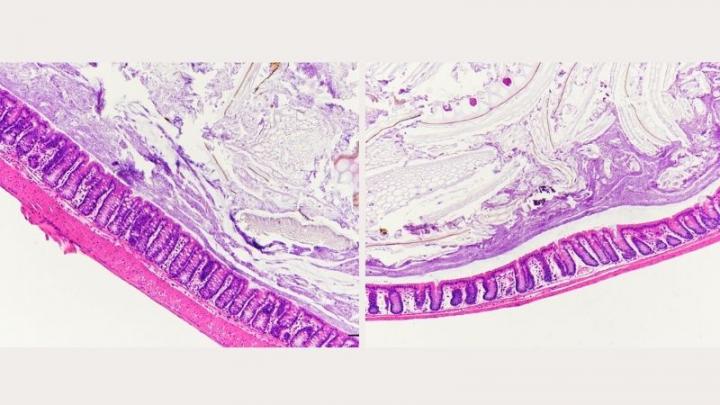 Colon Sections