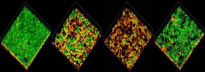 Pneumococcal Biofilms 