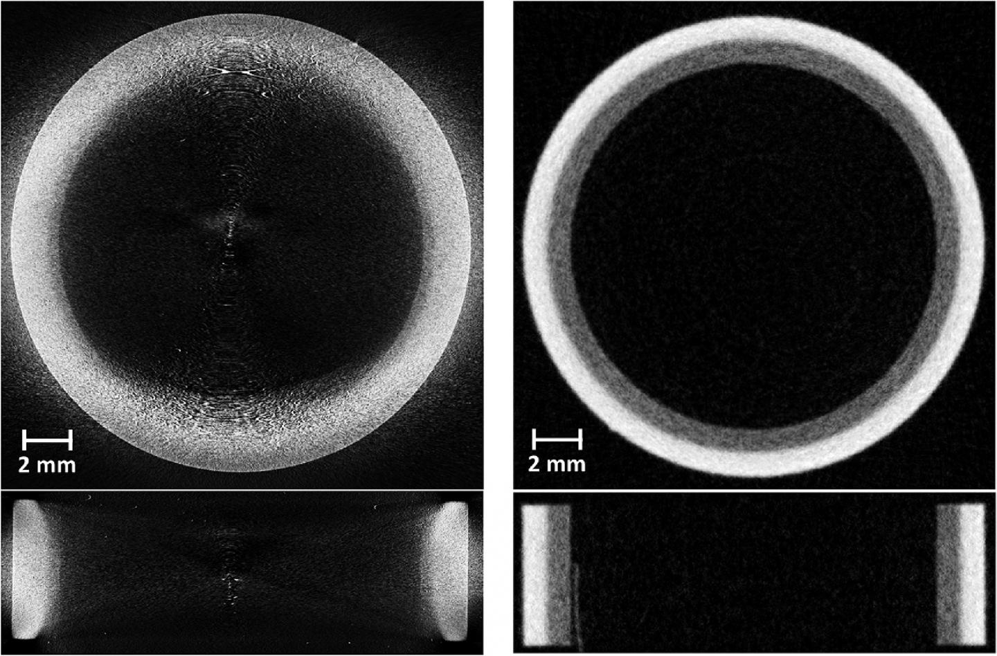 Fusion Energy, Better Imaging: X-Ray (Left) Neutron (Right)