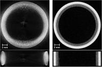 Fusion Energy, Better Imaging: X-Ray (Left) Neutron (Right)