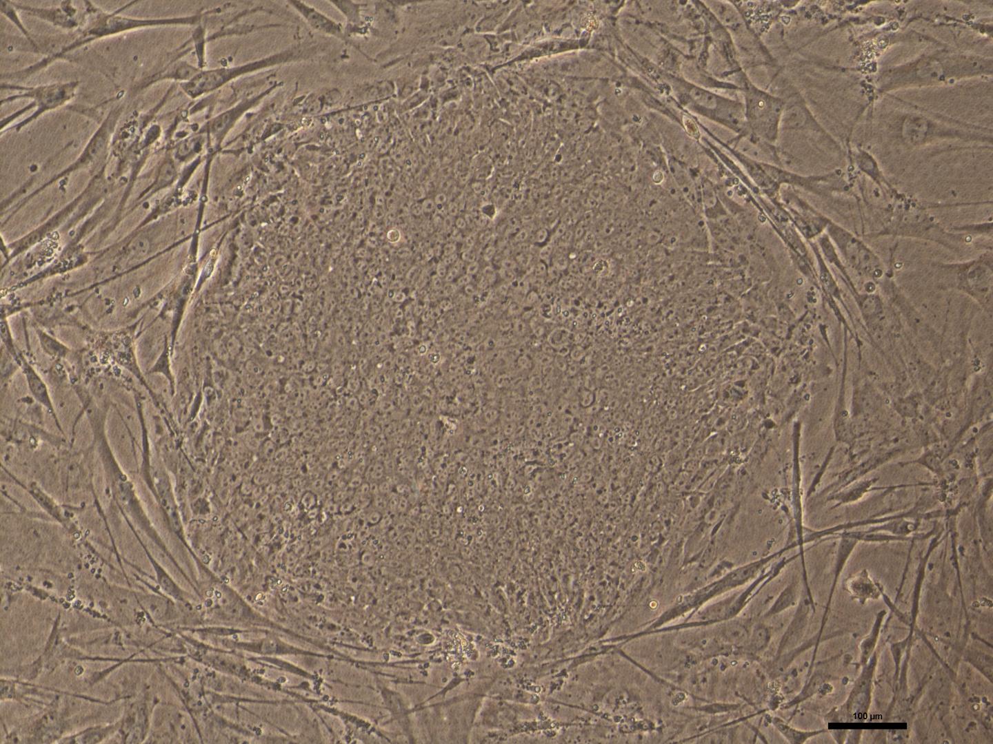 Colony of Human Induced Pluripotent Stem Cells