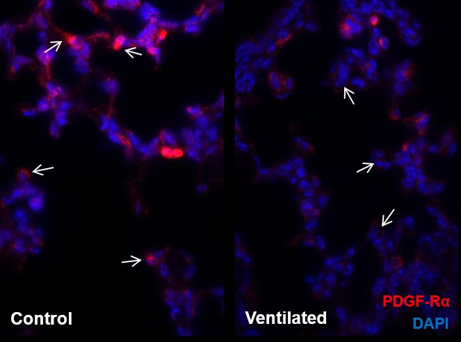 Production of PDGF-Rα in Case of Mechanical Ventilation
