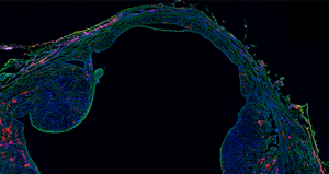 Erk activation in the injured spiny mouse heart