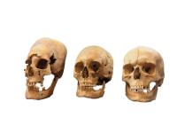 Strong, Intermediate, and Non-Deformed Skulls