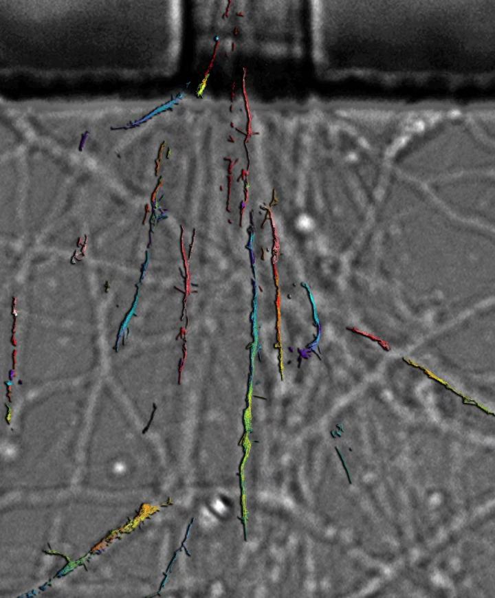 Botox in the Central Nervous System