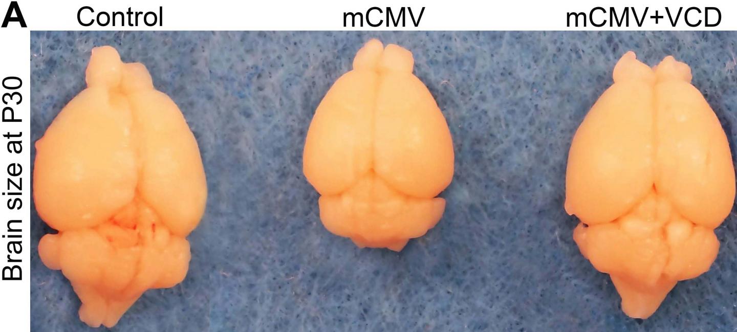 Valnoctamide Reverses Deficient Brain Growth Induced by mCMV Infection