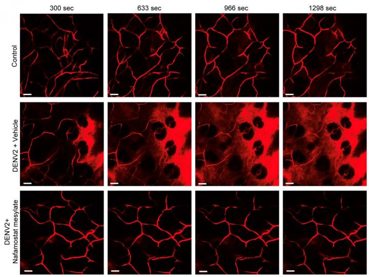 Tryptase Inhibition Reduces Vascular Leakage in Dengue Virus (DENV) Infected Preclinical Models