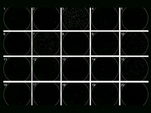 molecular signal shines green when HIV is detected