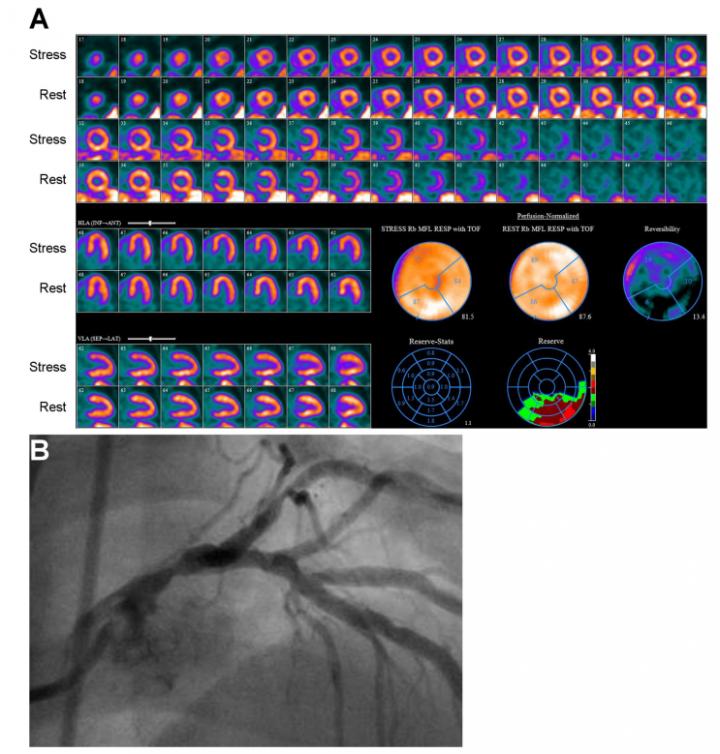 Clinical Utility of Blood Flow Quantification