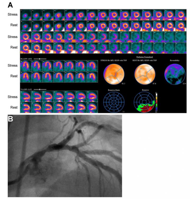 Clinical Utility of Blood Flow Quantification