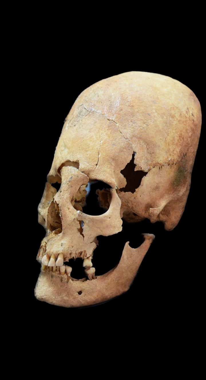 Artificially Deformed Female Skull