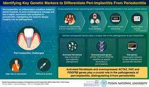 Identifying key genetic markers to differentiate peri-implantitis from periodontitis