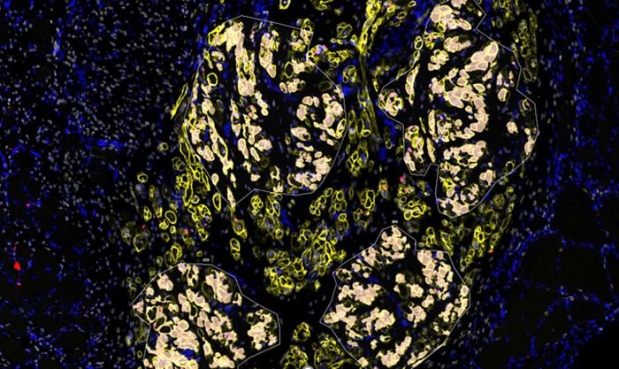 Lab-grown skeletal muscle