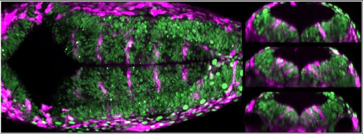 Posterior Brain of a Transgenic Zebrafish Embryo