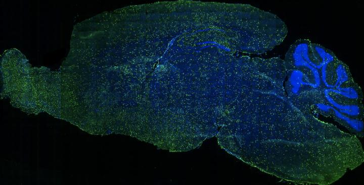 Brain After Transplantation